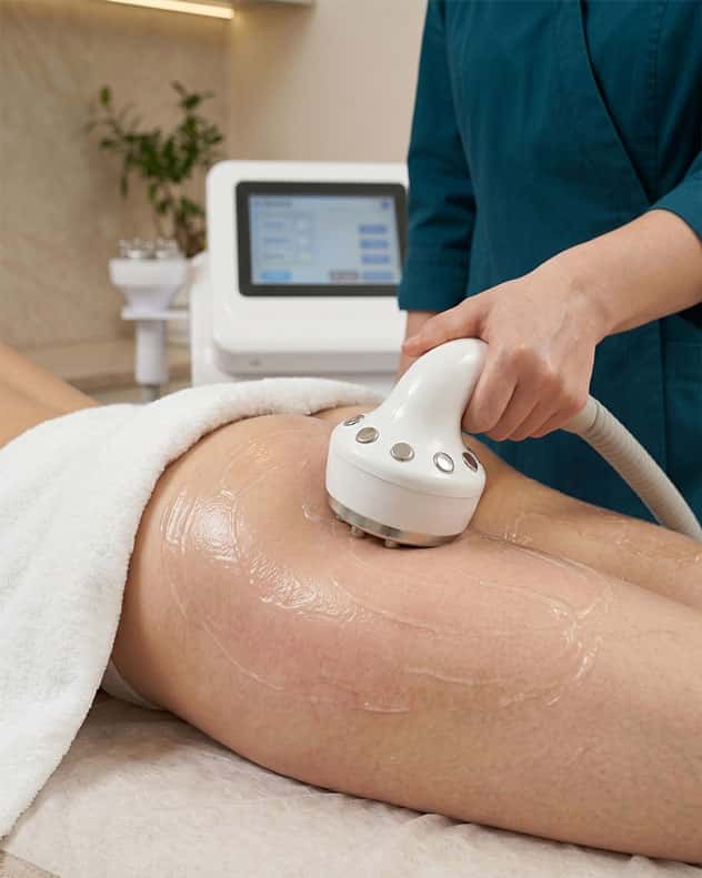 Radiofrekvence ķermenim pakalpojuma vizuālais priekšskatījums
